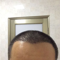 發(fā)際線用戶圖片