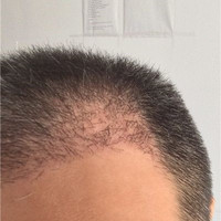 發(fā)際線用戶圖片