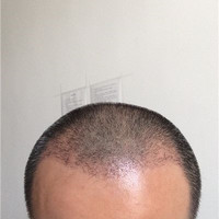 發(fā)際線用戶圖片