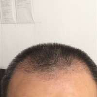 發(fā)際線用戶圖片