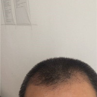 發(fā)際線用戶圖片