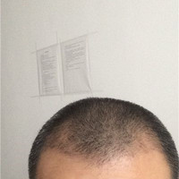 發(fā)際線用戶圖片