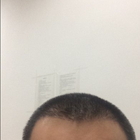 發(fā)際線用戶圖片