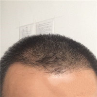 發(fā)際線用戶圖片