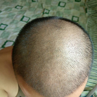 發(fā)際線用戶圖片