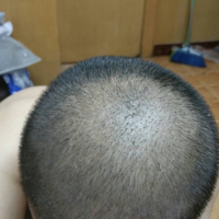 發(fā)際線用戶圖片