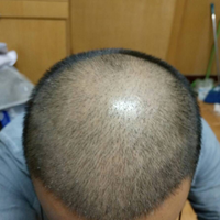發(fā)際線用戶圖片