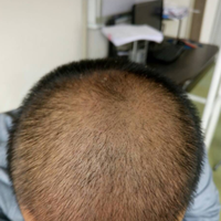 發(fā)際線用戶圖片