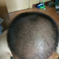 發(fā)際線用戶圖片