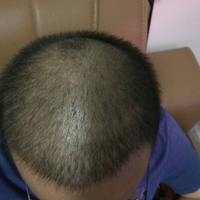 發(fā)際線用戶圖片