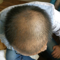 發(fā)際線用戶圖片