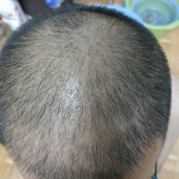 發(fā)際線用戶圖片