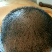 發(fā)際線用戶圖片