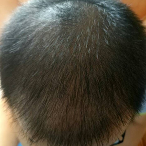 发际线分享社区