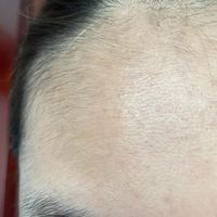 發(fā)際線用戶圖片