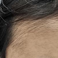 發(fā)際線用戶圖片