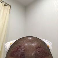 發(fā)際線用戶圖片