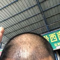 發(fā)際線用戶圖片