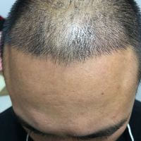 發(fā)際線用戶圖片