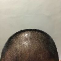 發(fā)際線用戶圖片