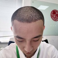發(fā)際線用戶圖片