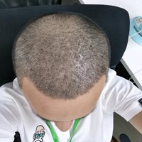 發(fā)際線用戶圖片