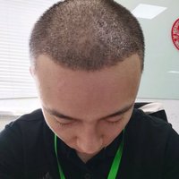 發(fā)際線用戶圖片