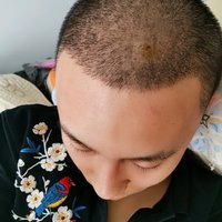 發(fā)際線用戶圖片