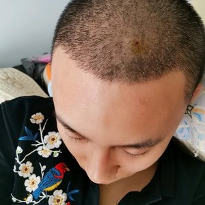 发际线分享社区