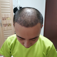 發(fā)際線用戶圖片