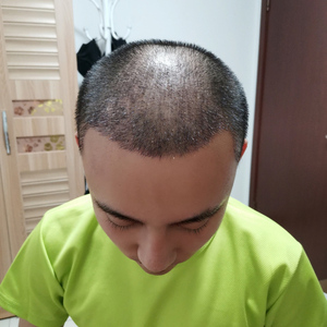 发际线分享社区