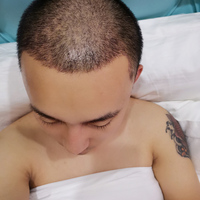 發(fā)際線用戶圖片