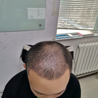 發(fā)際線用戶圖片
