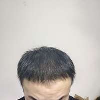 失敗修復(fù)用戶圖片