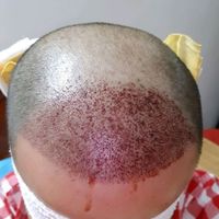 發(fā)際線用戶圖片