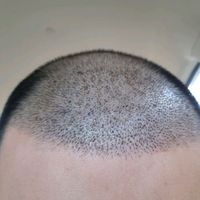 發(fā)際線用戶圖片