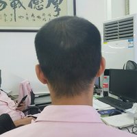 發(fā)際線用戶圖片