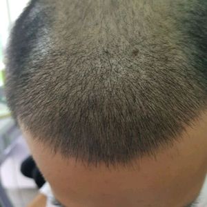 发际线分享社区