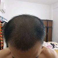 發(fā)際線用戶圖片