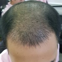 發(fā)際線用戶圖片