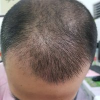 發(fā)際線用戶圖片