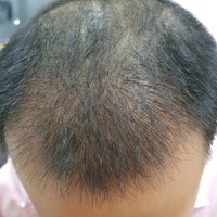 發(fā)際線用戶圖片