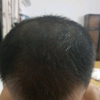 發(fā)際線用戶圖片