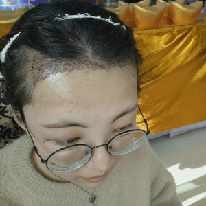 发际线分享社区