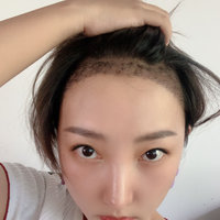 發(fā)際線用戶圖片