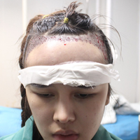 發(fā)際線用戶圖片