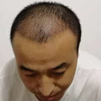 發(fā)際線用戶圖片