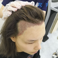 發(fā)際線用戶圖片