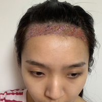 發(fā)際線用戶圖片