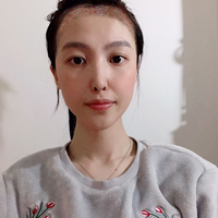 發(fā)際線用戶圖片